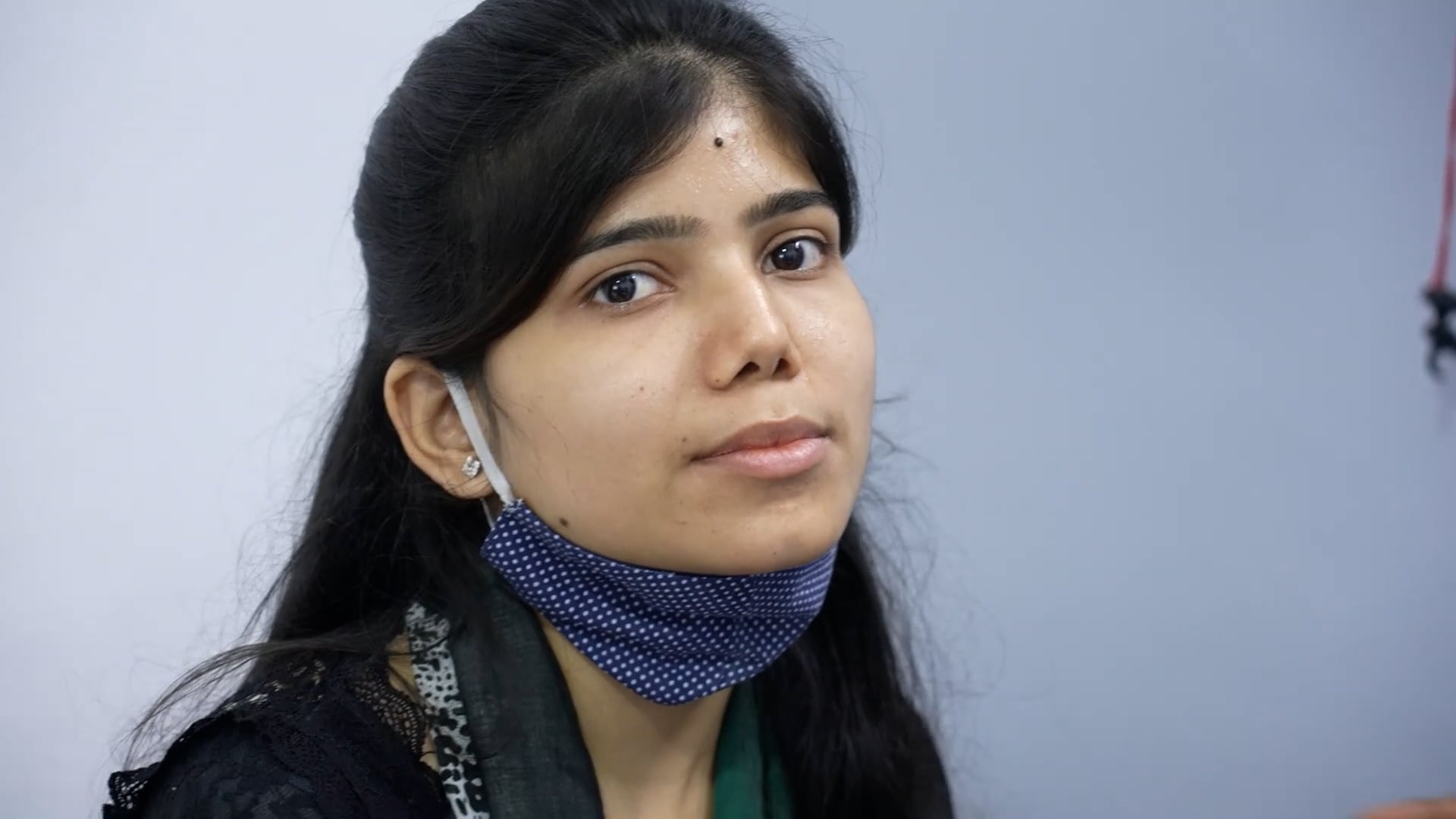 Rhinoplasty Complete Surgery